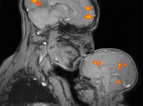 fMRI scan of a parent with their child
