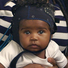 baby with headgear on